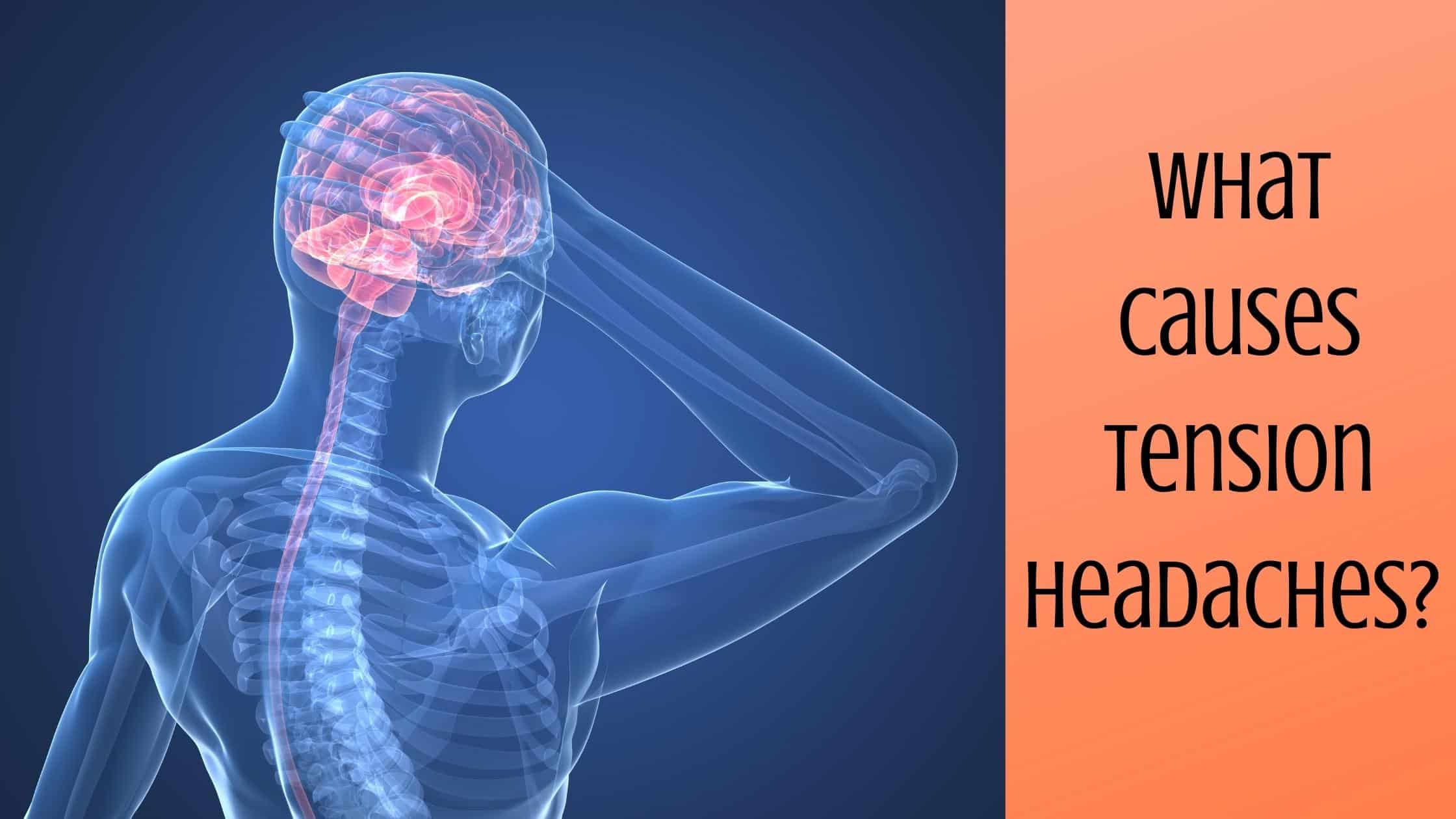 tension-headache-locations-causes-and-treatments-by-treat-headaches